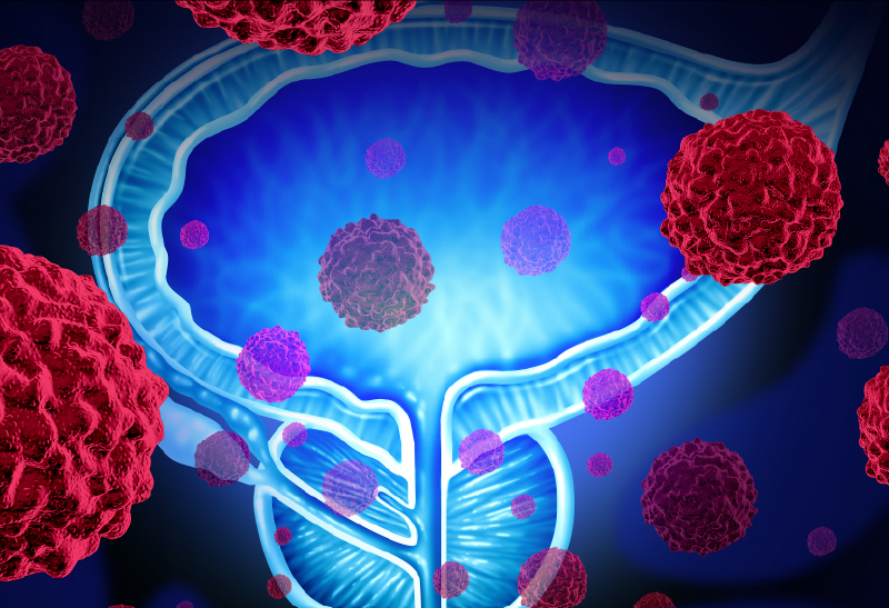 Produtos Naturais Bioativos para Quimioprevenção e tratamento de Câncer de Próstata resistente à Castração